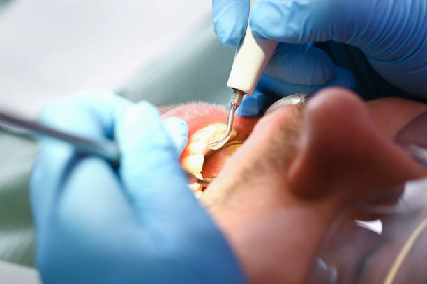 Best Emergency Dental Care for Abscessed Tooth in Brunswick, MD