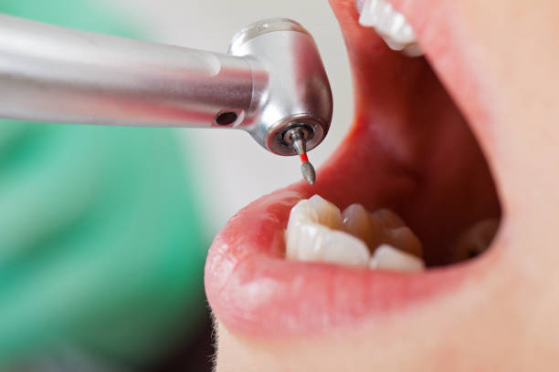 Best Emergency Cosmetic Dentistry in Brunswick, MD